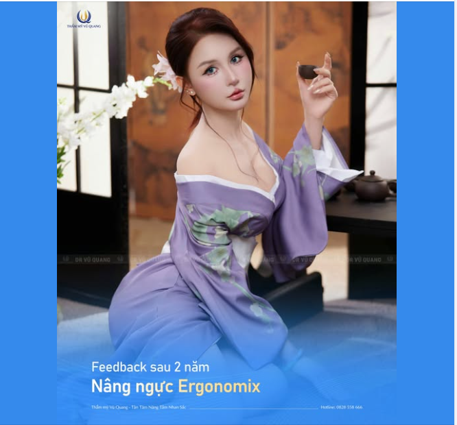 FEEDBACK SAU 2 NĂM NÂNG NGỰC ERGONOMIX...