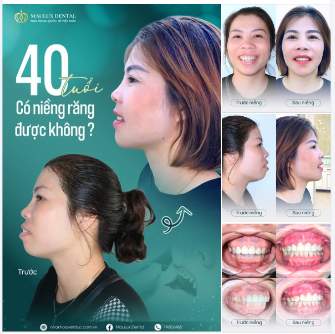 40 tuổi – Chị Thành vẫn quyết định “làm mới” chính mình!