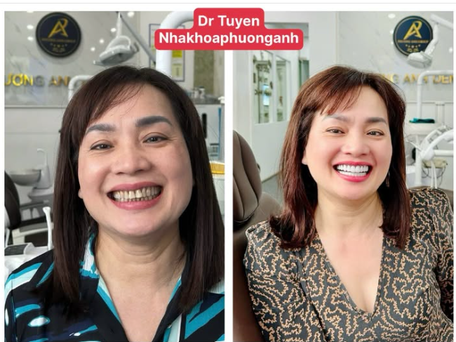 Nụ cười mới – diện mạo mới