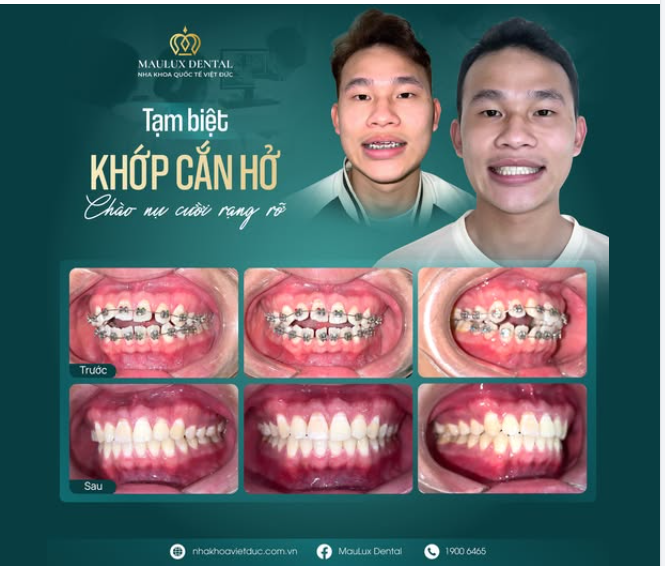 2 NĂM THAY ĐỔI – NỤ CƯỜI TỰ TIN HƠN BAO GIỜ HẾT