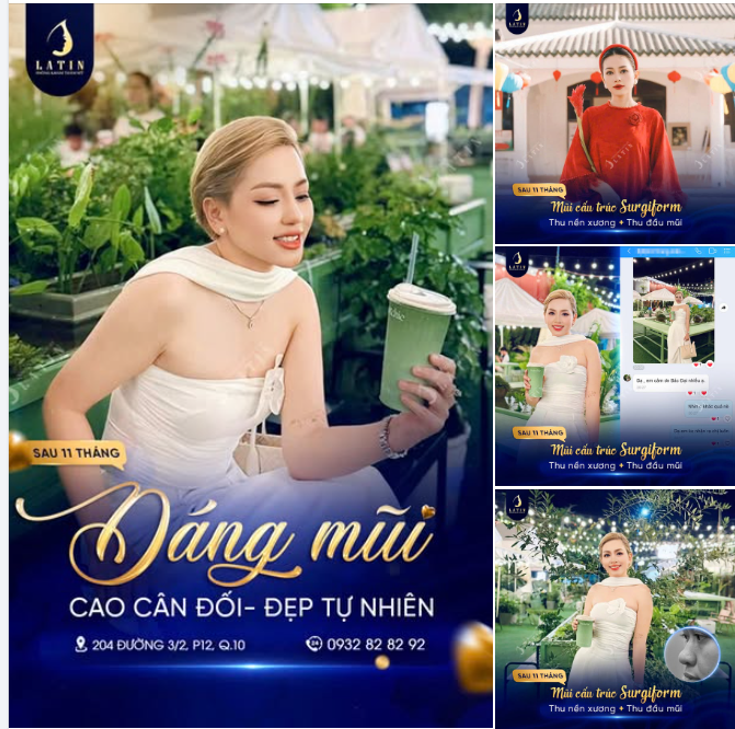 COMBO NÂNG MŨI, THU NỀN XƯƠNG, THU ĐẦU MŨI – ĐẸP TỰ NHIÊN, HỢP MẶT TỪNG NÉT