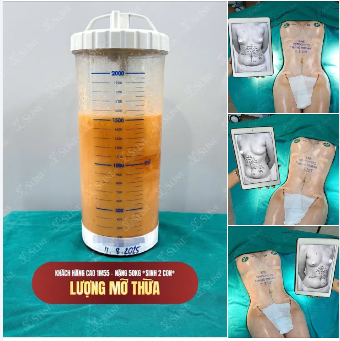 HÀNH TRÌNH “LỘT XÁC” SAU SINH