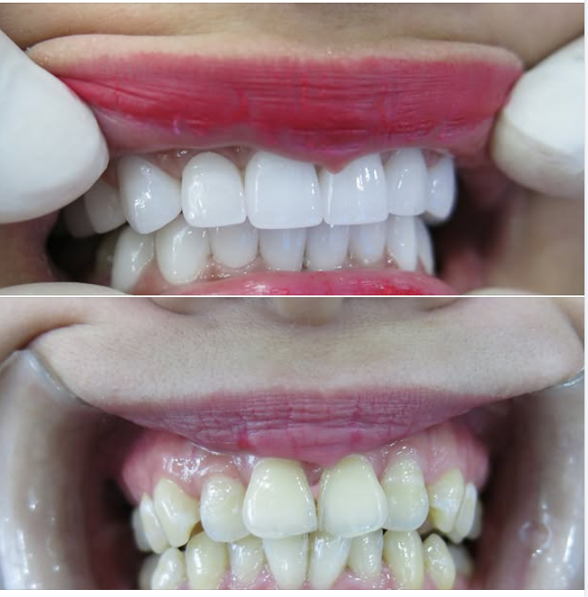 Nụ cười thay đổi – cuộc sống cũng đổi thay.