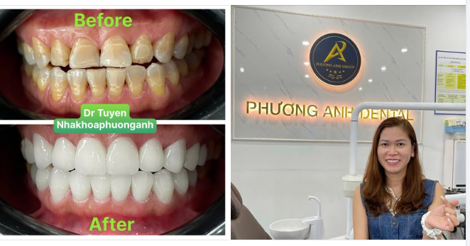 Phương Anh Dental – Nơi biến đổi nụ cười, thắp sáng cuộc đời.