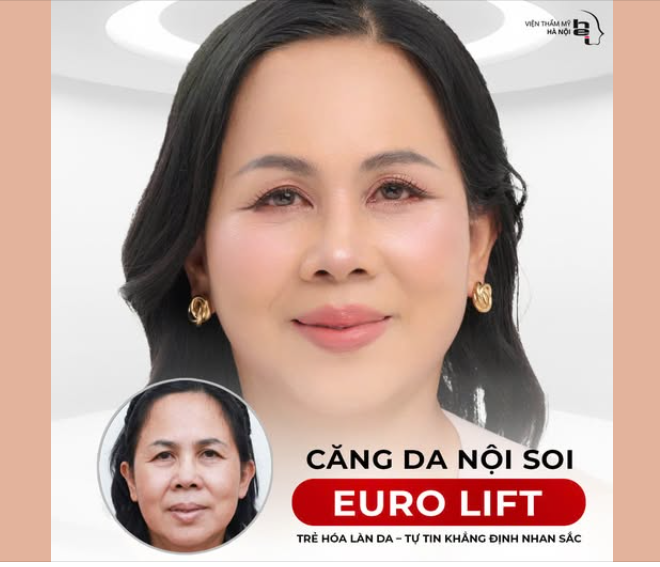 CĂNG DA NỘI SOI EURO LIFT