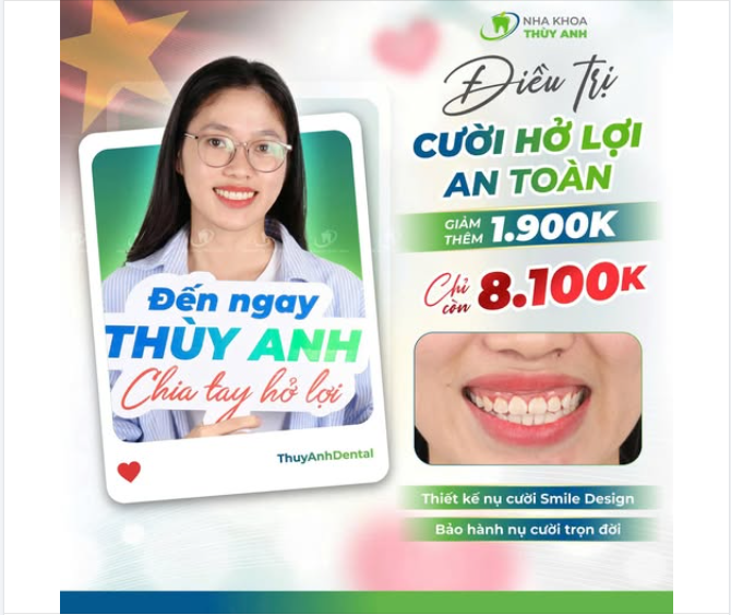 HỞ LỢI, NGẠI CƯỜI? BẠN CHỈ CẦN 45 PHÚT ĐỂ LẤY LẠI DUYÊN DÁNG