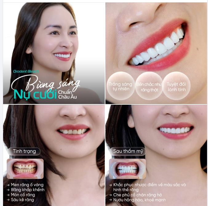 Orodent Bleach - Bừng sáng nụ cười chuẩn châu Âu