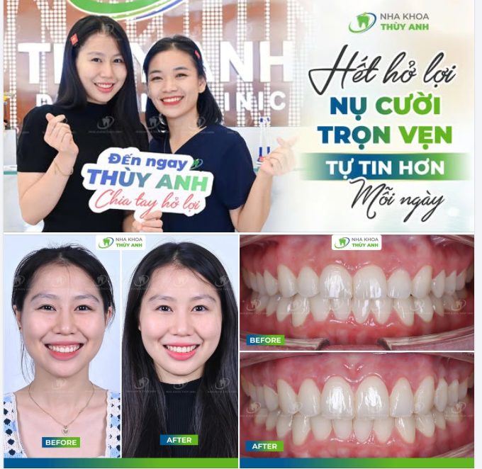 ĐẸP VÀ ĐẸP HƠN - ĐIỀU MÀ CÔ GÁI NÀO CŨNG MUỐN LÀM CHO BẢN THÂN