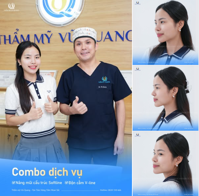 Thay đổi hoàn toàn diện mạo - 60p có ngay mũi đẹp, cằm xinh siêu tựu nhiên