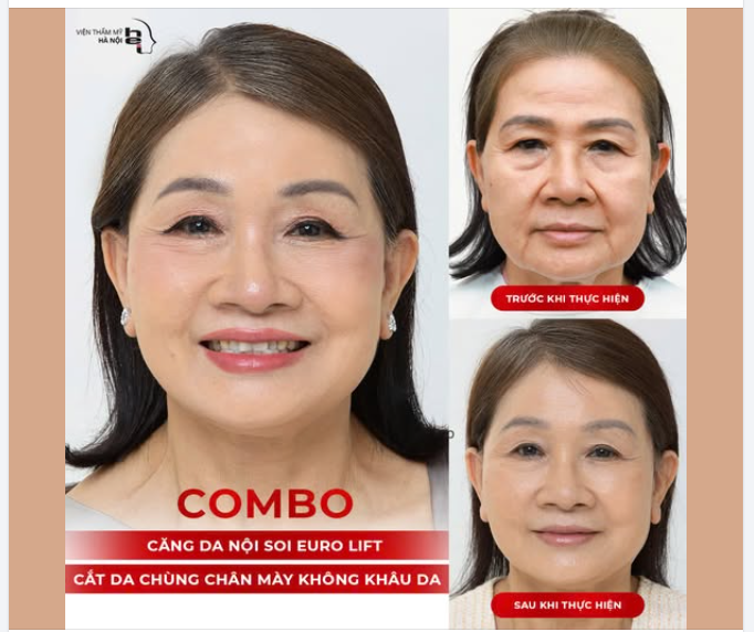 COMBO TRẺ HOÁ TOÀN DIỆN