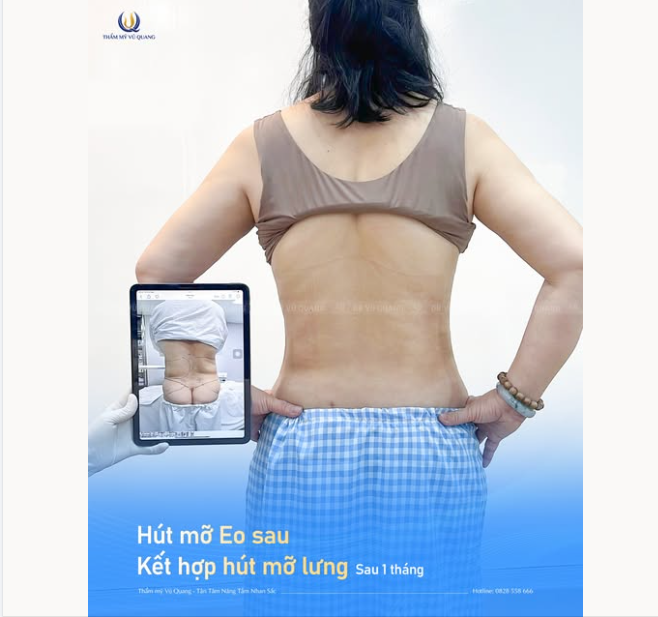 LƯNG THON - EO NHỎ DÁNG XINH QUYẾN RŨ