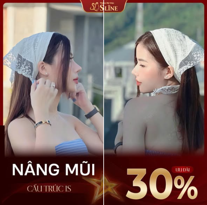 MỪNG QUỐC KHÁNH – NÂNG MŨI GIẢM SÂU ĐẾN 30%