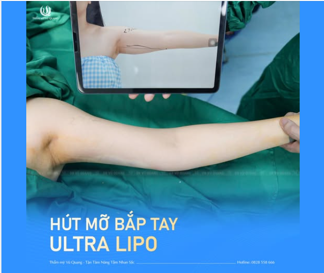 Người nhỏ nhưng bắp tay to?