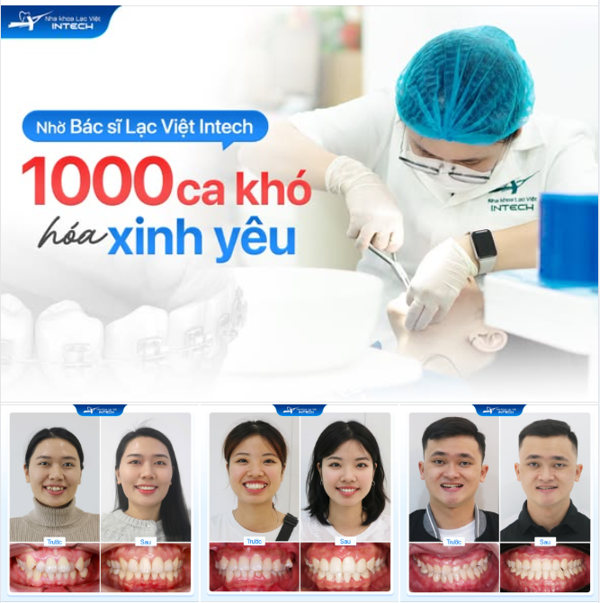 Mất răng, răng ngầm, lệch khớp nặng – những ca khó đều có lời giải tại Nha khoa Lạc Việt Intech!