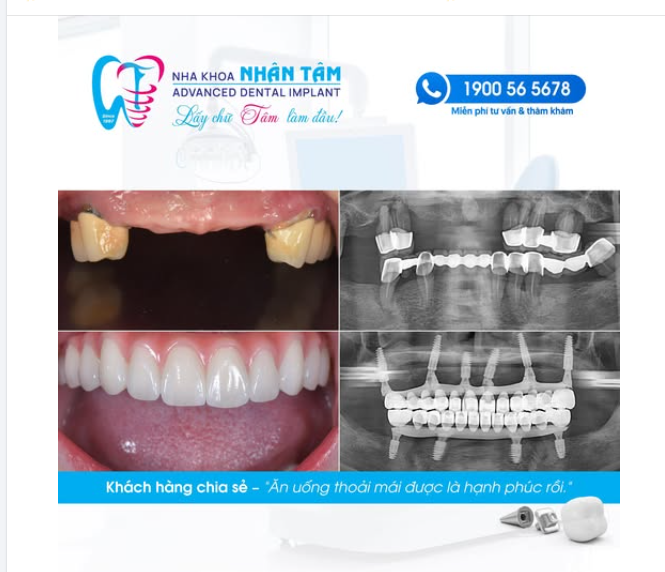 “ĂN UỐNG THOẢI MÁI ĐƯỢC LÀ HẠNH PHÚC RỒI!”