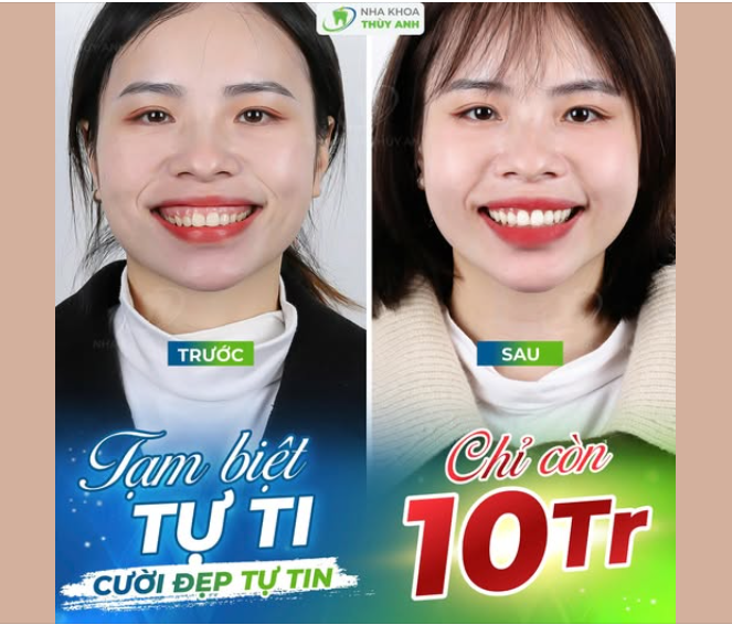 CHỈ CẦN THAY ĐỔI NỤ CƯỜI, CẢ DIỆN MẠO LỘT XÁC NGOẠN MỤC