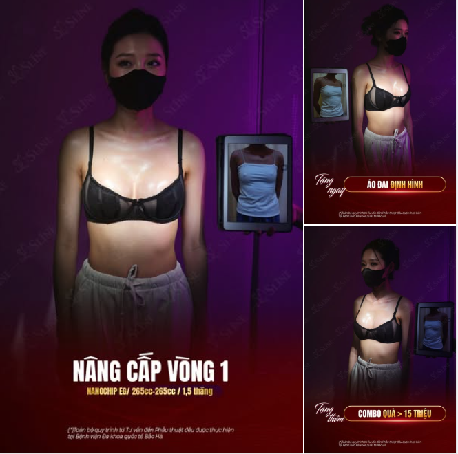 NÂNG CẤP VÒNG 1 – KHÁCH HÀNG CHỌN SLINE