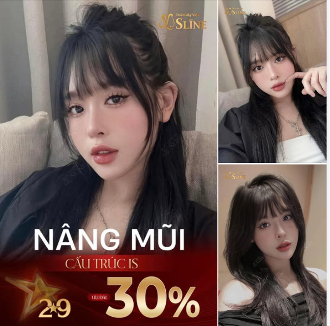 NÂNG MŨI CẤU TRÚC IS – ĐƯỜNG CONG HOÀN MỸ