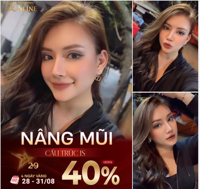 NÂNG MŨI CẤU TRÚC IS – DEAL KHỦNG 4 NGÀY VÀNG