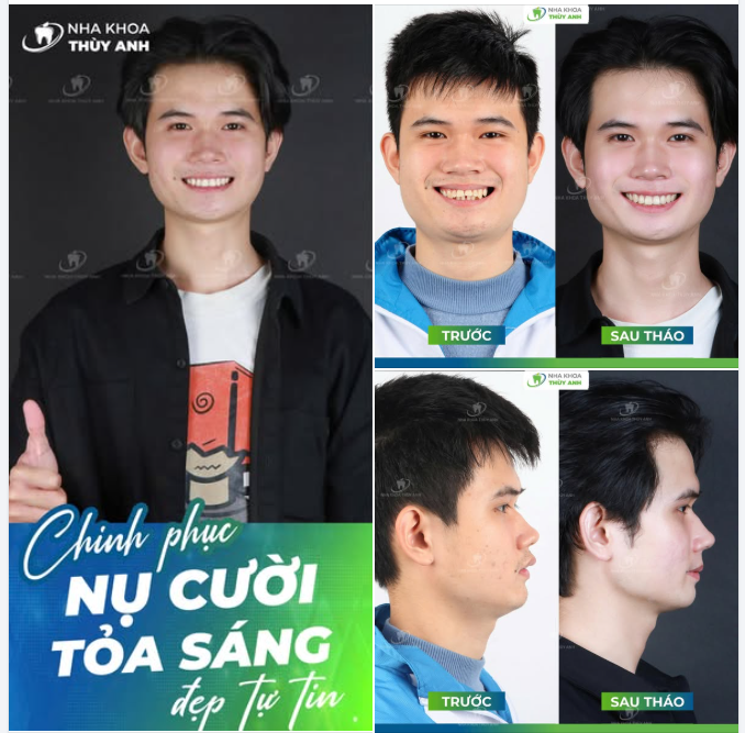 MỘT QUYẾT ĐỊNH ĐÚNG - CHO NỤ CƯỜI ĐẸP MỘT ĐỜI