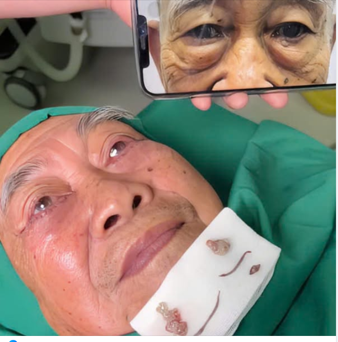 QUÝ ÔNG VIỆT KIỀU U70 SỞ HỮU ĐÔI MẮT TRẺ 10 TUỔI SAU THỰC HIỆN TRẺ HÓA MẮT TẠI JW