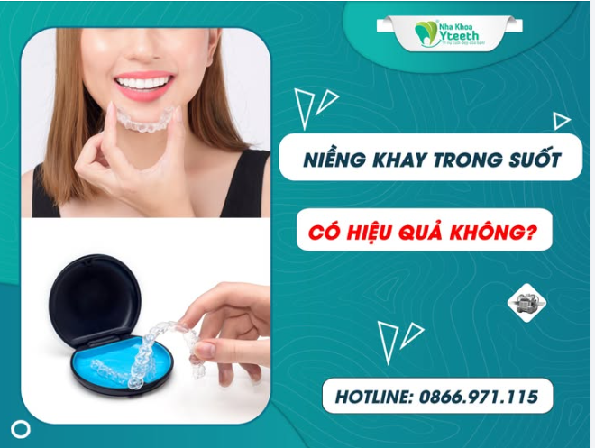 Bạn đang đi làm, gặp khách hàng, phải giữ hình ảnh chỉn chu?