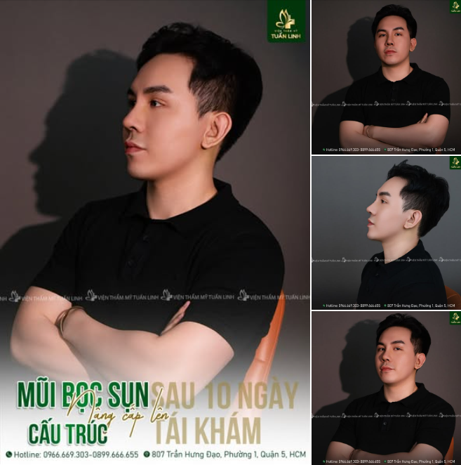 Nâng cấp lên mũi cấu trúc - Nhận thêm ƯU ĐÃI từ Tuấn Linh!!