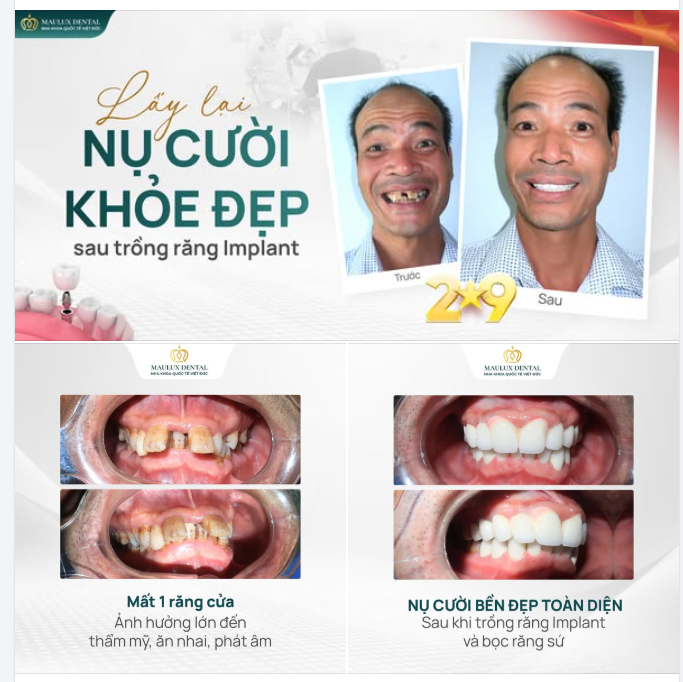 TÌM LẠI NỤ CƯỜI - TÌM LẠI SỰ TỰ TIN