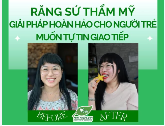 Răng Sứ Thẩm Mỹ – Giải Pháp Hoàn Hảo Cho Người Trẻ Muốn Tự Tin Giao Tiếp