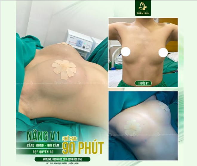 NÂNG V1 - GỢI CẢM, AN TOÀN, ĐẸP QUYẾN RŨ!!