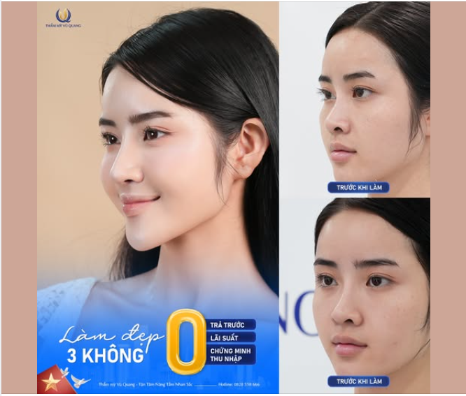 MŨI XINH CHẠM ĐỈNH - ƯU ĐÃI RỦNG RỈNH