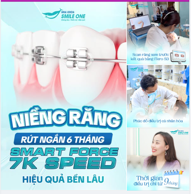 NIỀNG RĂNG RÚT NGẮN XUỐNG 6 THÁNG