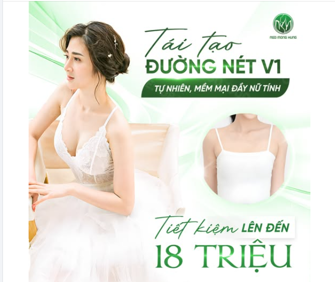 TÁI TẠO ĐƯỜNG NÉT V1 TỰ NHIÊN, MỀM MẠI ĐẦY NỮ TÍNH