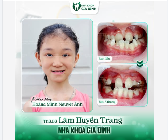 BỐ MẸ ƠI, CON SẮP HẾT MÓM RỒI !!!