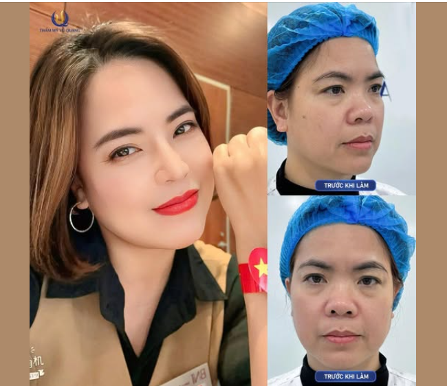 Đẹp xinh không lo giá tại Thẩm mỹ Vũ Quang!