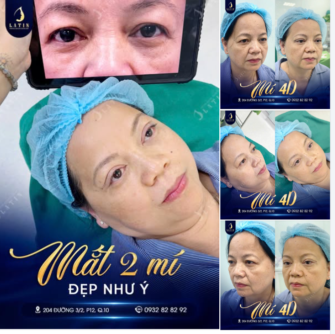 THỨC TỈNH ÁNH NHÌN - TRẺ HÓA ĐÔI MẮT TUỔI TRUNG NIÊN