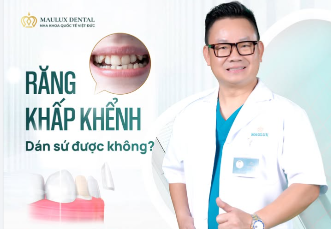 RĂNG KHẤP KHỂNH – CÓ DÁN SỨ ĐƯỢC KHÔNG?