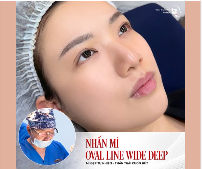 NHẤN MÍ OVAL LINE WIDE DEEP