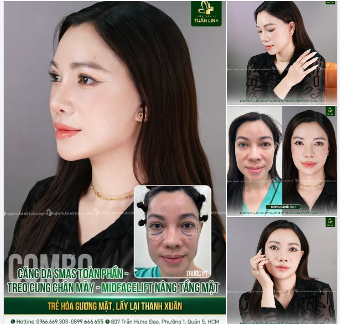 COMBO LẤY LẠI THANH XUÂN