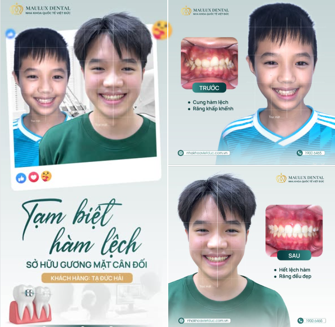 MỪNG NGÀY THÁO NIỀNG KHÁCH HÀNG TẠ ĐỨC HẢI