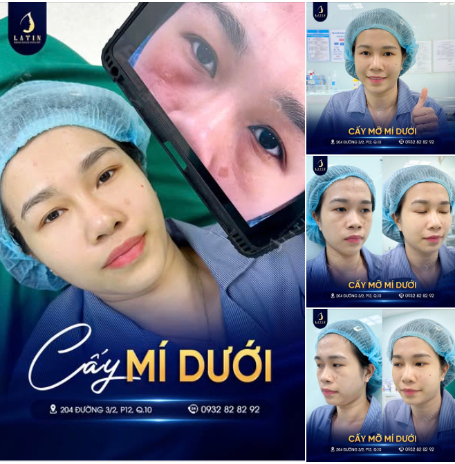 Xinh Đẹp Như Ý - Thẩm Mỹ An Toàn