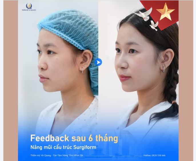 Ca phẫu thuật được thực hiện bởi Thạc sĩ BS Vũ Quang tại phòng mổ tiêu chuẩn của Bộ y tế