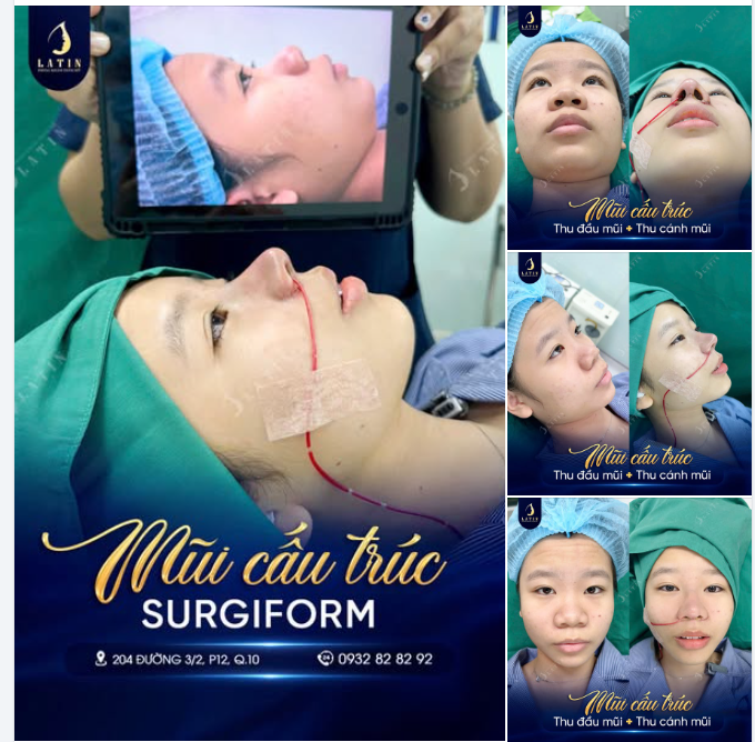 LÊN NHAN SẮC, LÊN TINH THẦN