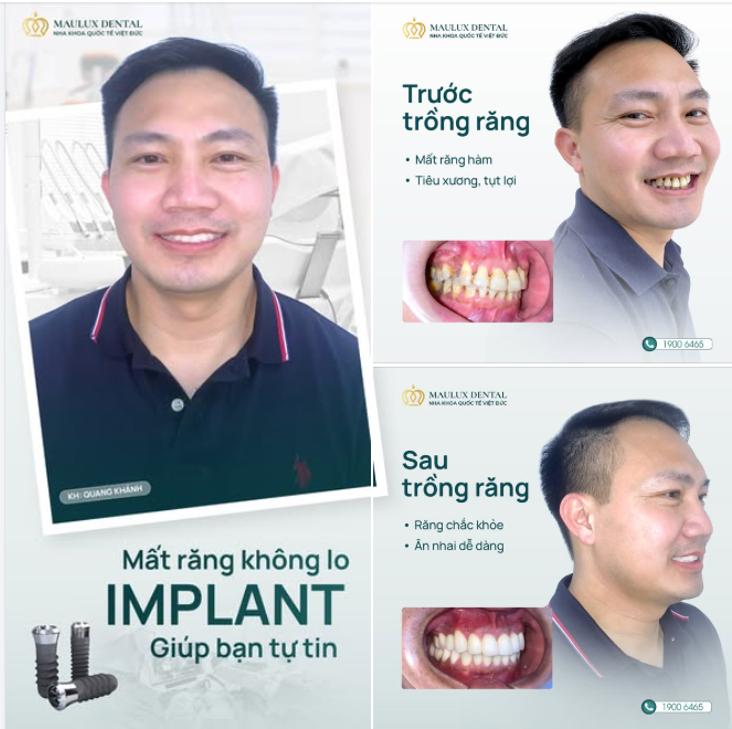 HÀNH TRÌNH TÌM LẠI NỤ CƯỜI - ANH NGUYỄN QUANG KHÁNH