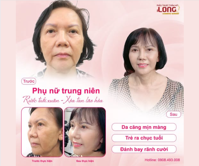 Người thật - Hiệu quả thật