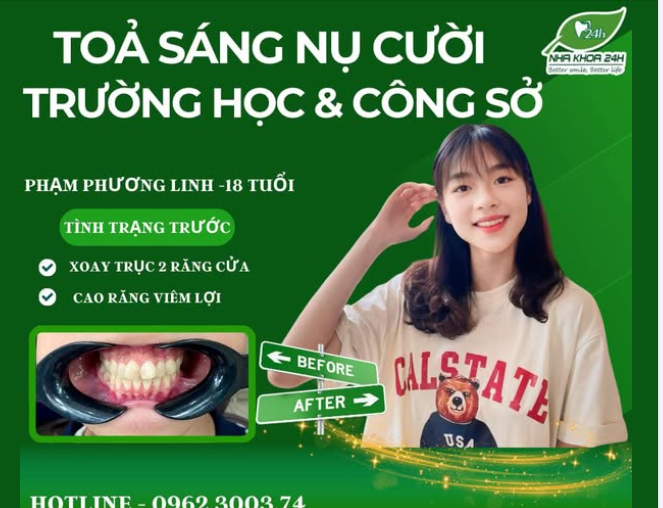 Răng Sứ Thẩm Mỹ – Tỏa Sáng Nụ Cười Trường Học và Công Sở