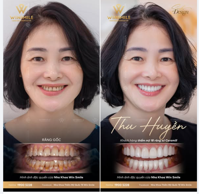 THAY ĐỔI RẠNG NGỜI SAU 50 NĂM CHỜ ĐỢI NỤ CƯỜI MỚI