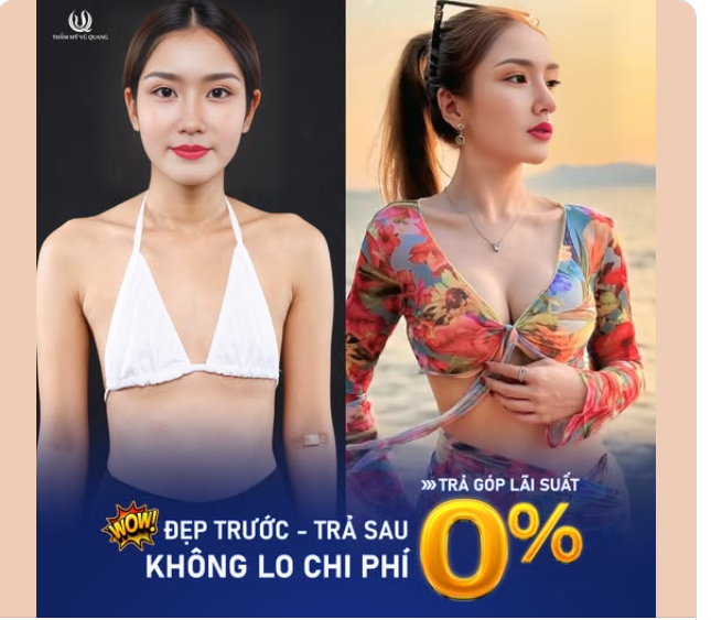 Nâng ngực GIÁ GỐC – Trả góp 0% – Không phát sinh chi phí