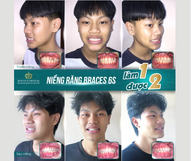 MỪNG NGÀY THÁO NIỀNG KHÁCH HÀNG BÙI VĂN TUẤN
