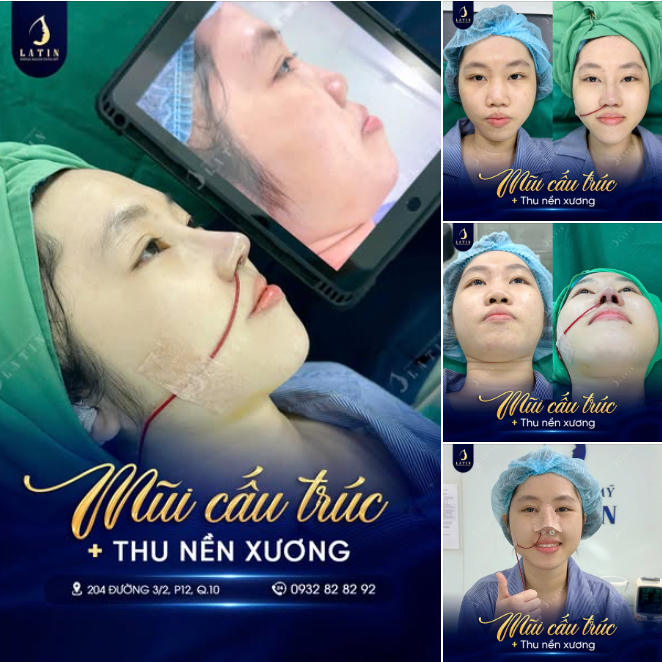 MŨI XINH VỪA “CHỚP MẮT” ĐÃ CÓ